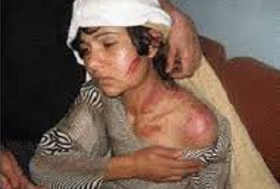 One of the Kunan Poshpora Gangrape victims | Photo Source: Kashmir Diaspora Alliance